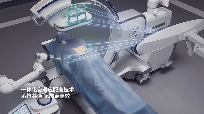 脊柱手術(shù)機器人一體化自適應配準技術(shù)